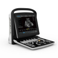 Ultrassônica Ultrasound Scanner preto branco Doppler portátil portátil (SC-ECO3)